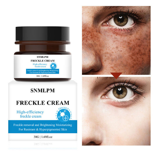 Whitening Freckle Cream